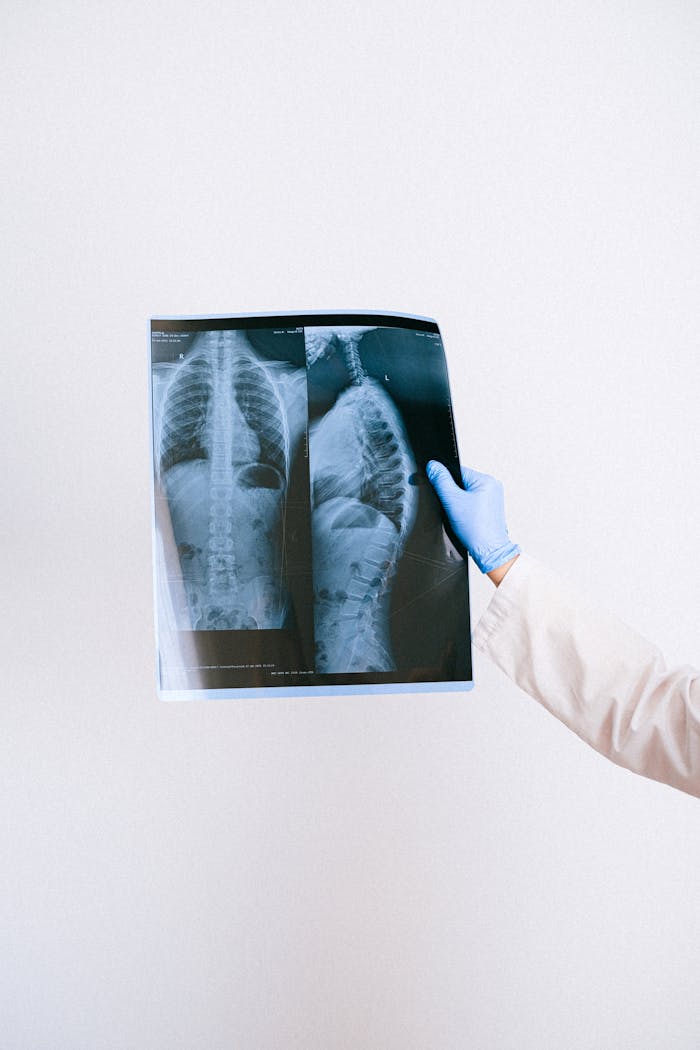 A medical professional holds an X-ray image showing chest and spinal details.